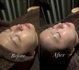 【💎人気No.1💎】毛穴レス美肌を今すぐ体験✨️【シンデレラピーリング】韓国水光肌｜毛穴ピーリング🌱9800円💖