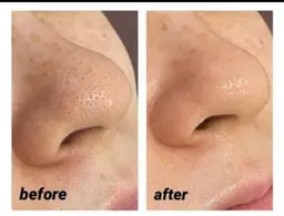 毛穴洗浄(鼻のみ)💖