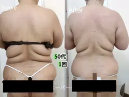 当日限定【痩身モニター募集】脂肪・セルをほぐし!全身痩身120分　¥28,800