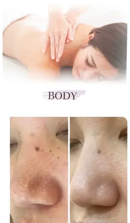 ボディリンパ(60分)+ハーブピーリング(痛み&ダウンタイムなし)