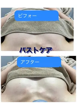 【スタイルアップ💖バストケア💗】30分　高周波の温かさでリンパ、バスト周りの脂肪にアプローチ＆光照射✨ふっくら🌟