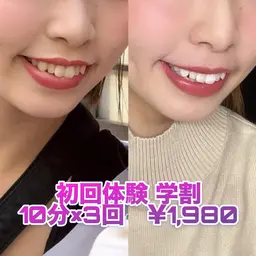【1日3名様限定】🌟初回体験🌟学割👩‍🎓セルフホワイトニング10分×3回​〜​安心のカウンセリング付き​〜​✨✨