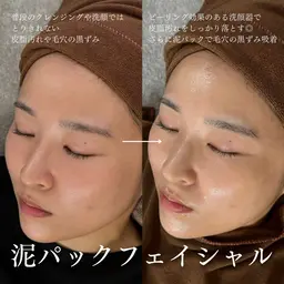 【毛穴ごっそり】深海クレイの泥パック洗浄✨毛穴の黒ずみ・ザラつきを解消して清潔感UP。