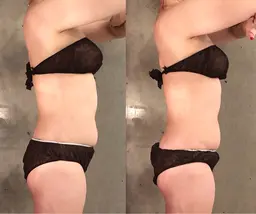 痩せたい部分に特化！最新マシンで脂肪撃退＆リンパ通常