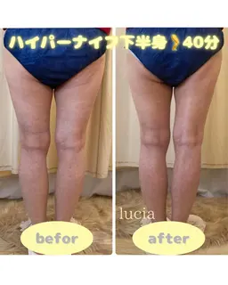 ハイパーナイフ下半身🦵＋強力リンパマッサージ✨40分