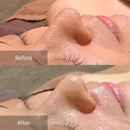 【10月限定🎃毛穴洗浄×顔脱毛】 ツルピカ卵肌へ🥚✨ 40分