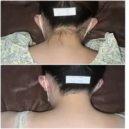 【お好きな部位を1箇所3回🌸】当店の脱毛は痛みもなくお肌が敏感な方も◎純国産機取り扱いサロン♪シェービング代無料✨