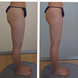 劇的✨脚痩せコース✨