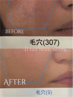 💎リピーター様限定💎美肌カウンセリング＆スキンケア体験