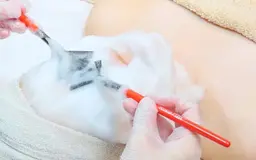 ＊当日限定クーポン♡韓国肌管理ララピール＊ツヤ肌/水光肌/ダウンタイムなし※初めての方大歓迎◎