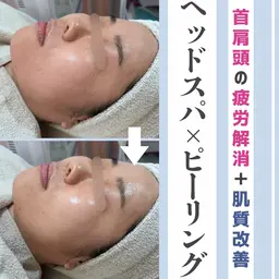 〈NEW🩵〉お好きなピーリング➕ドライヘッドスパ20分🫧