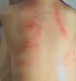 ♦minimo限定♦🩵男性🩵🌼オイルマッサージ+スライドカッピング40分🌼【肩周り+背面全面】