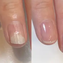 オーナー津蔵とスタッフが担当する『ハンドの剥離解消メニュー』 無料　※必ず補足説明をご確認ください。