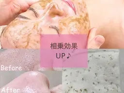 剥離なし◎毛穴エクストラクション＋ハーブピーリング