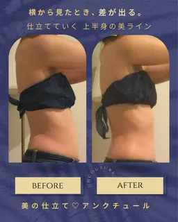 【上半身痩身】横から見た腰肉・お腹ラインが変わる痩身