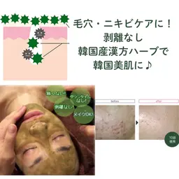 剥離無し🌿漢方ハーブピーリング★¥8000→【初回¥6000】