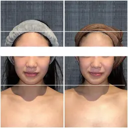 【🌸4月中5名様限定🌸】首肩こりを楽にして小顔にするこりとりコルギ+オプション付き💕90分❣️