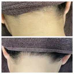 うなじシェービング🪒＋光脱毛お試し価格💁‍♀️