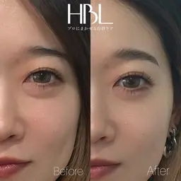 HBL(眉癖改善)💎眉周りwax or シェービング選択可能✨