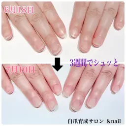 自爪育成ジェル（ホームケア付き）初回1000円OFF