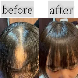 前髪割れ癖改善クロスパーマ+前髪縮毛矯正