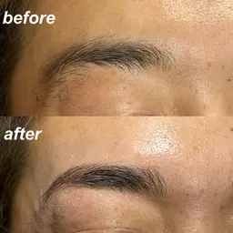 【メンズモテ美眉】ハリウッドブロウリフト+ひげ脱毛