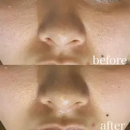 お肌に透明感を♪くすみに◎小顔コルギ＋頭蓋骨調整＆石膏パック 110分コース