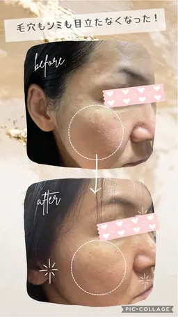 🌈女性限定🌈フェイシャルエステ