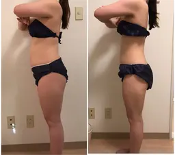 【平日ニミモU25限定】凸凹肉割れ撃退❗️最新痩身機器🌟90分全身痩せ2回セット✨通常￥44,000→¥15000