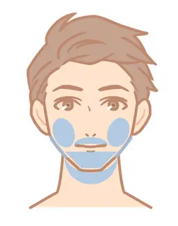 ★当店人気No.１★【顔ヒゲ】脱毛