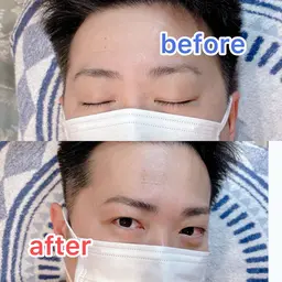 眉毛ワックス（カウンセリング）