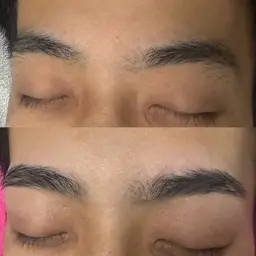 HBL（ハリウッドブロウリフト）