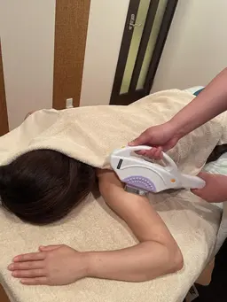 女性 脱毛 全身（顔・VIO除く）