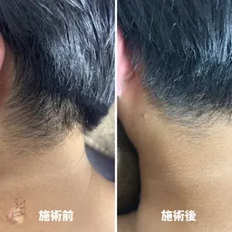 メンズライトボディケア