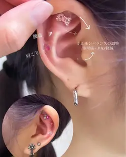 耳つぼジュエリー (両耳2​〜​6個)