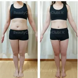 《結果重視》痩身エステ ～筋膜リリース ～