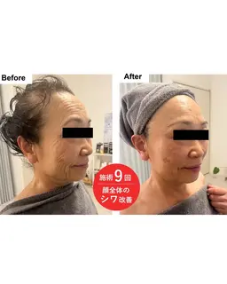 60分で-5歳肌✨プレミアムエステ🌸デコルテマッサージ付き