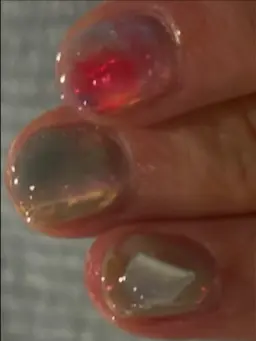 メニューについて相談🙋🏻