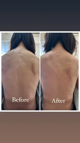 【🌟TikTokやyoutube用の動画撮影にご協力いただける方大募集🌟】首こり肩こり、コリから来る頭痛も改善します