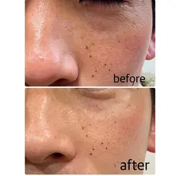 メンズフェイシャルコース✨天然ミネラルベースの角質ケアでさっぱりツルツルの仕上がりに^_^