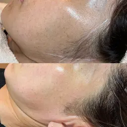 【くすみ徹底ケア】フェイスワックス＋透明感UPパック/化粧ノリUP