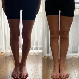 美容骨盤矯正(O脚・X脚改善)50分コース