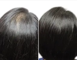 増毛エクステ500本(カウンセリング込)