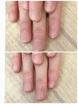 自爪つやアップ★ファイリング＋甘皮＋ささくれケア