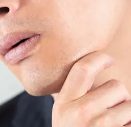 ⚫︎ メンズ髭脱毛（おでこ、ほほ、口周り、あご下）