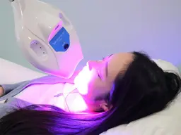 【期間限定】まずはお試し！20分照射🦷セルフホワイトニング⭐️平均4トーンアップ