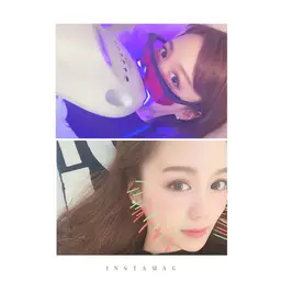 人気NO1メニュー美容鍼＋ホワイトニング美容鍼とホワイトニングのセットを受けれるのは大阪市内でも当院のみ！