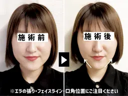 【迷ったらコレ◎】当日カウンセリングで最適提案（メニュー未定OK）