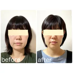 【小顔矯正＋ヘッドマッサージ✨】たるみ・眼精疲労・エラ張り・左右差などあらゆるお顔のお悩みに