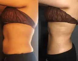 【小顔】【痩身】人気No.1大満足コース🏅 オーダーメイド90分💖時間内に選べる施術で満足度🆙